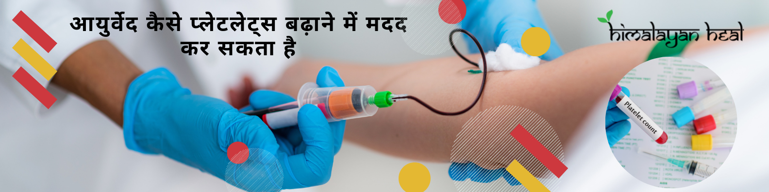 Blood platelets and ITP treatment in Ayurveda